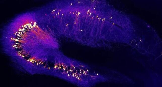 为什么形成记忆的神经元对阿尔茨海默症很脆弱