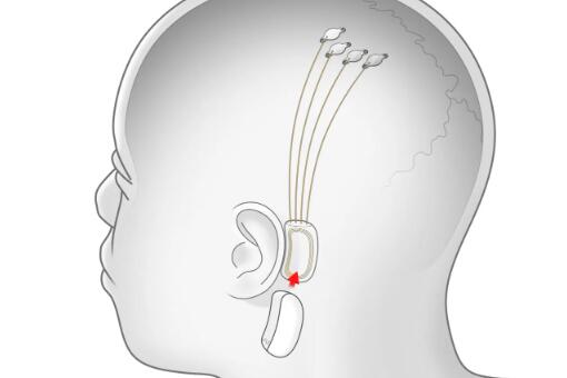 埃隆·马斯克将于8月28日发布有关人机界面公司Neuralink的更新