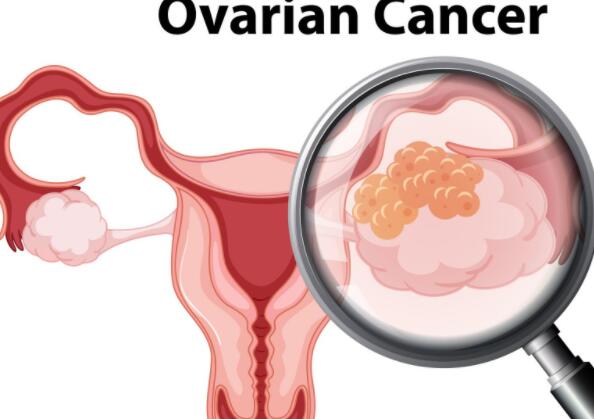 欧盟监管机构授予葛兰素史克卵巢癌治疗标签扩展计划