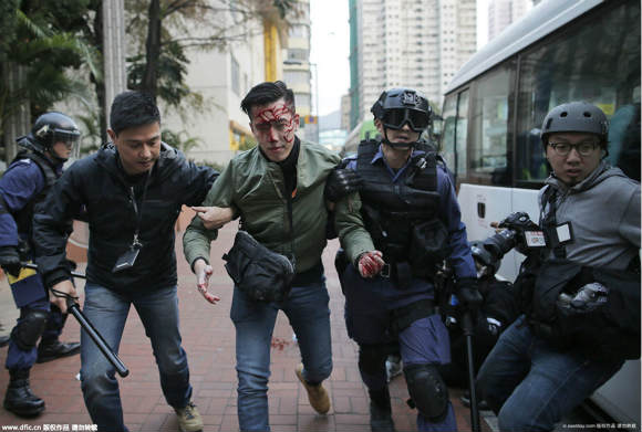 
中国新闻网冼副所长子弹打在哪里，美国有一句话：没事别惹警察